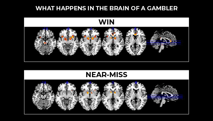 The mind of a gambling addict
